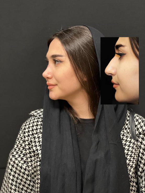 دکتر احمد احراری