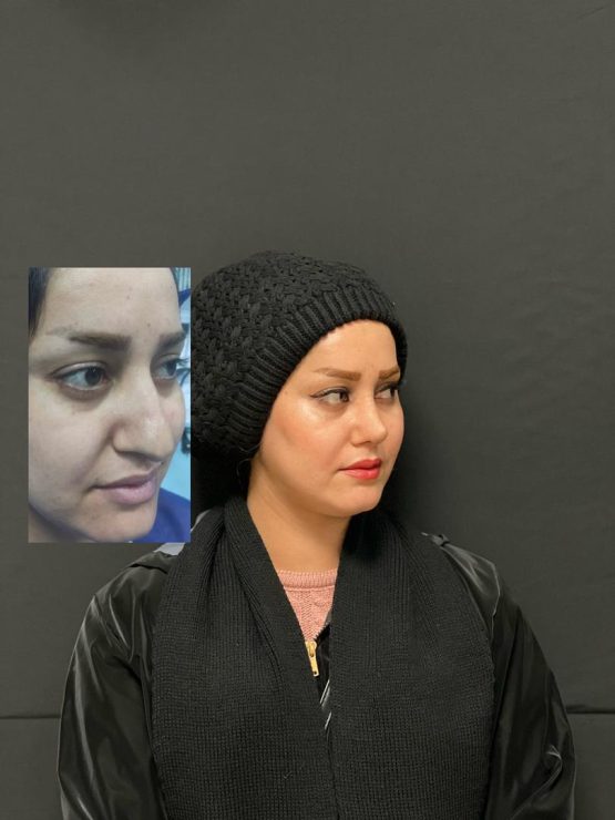 دکتر احمد احراری