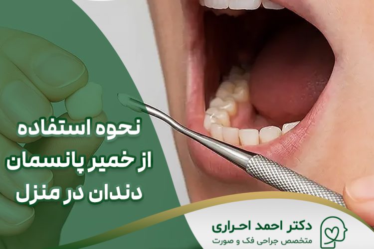 نحوه استفاده از خمیر پانسمان دندان در منزل
