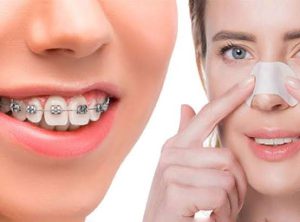 چند وقت بعد از عمل بینی میتوان به دندانپزشکی رفت؟