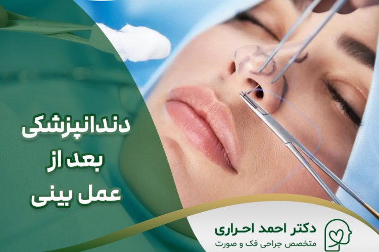 چند وقت بعد از عمل بینی میتوان به دندانپزشکی رفت؟