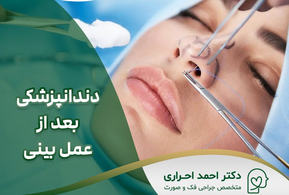 چند وقت بعد از عمل بینی میتوان به دندانپزشکی رفت؟